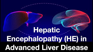 Hepatic Encephalopathy HE in Advanced Liver Disease [upl. by Hailed]