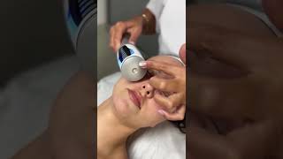 Endosphere Facial Therapy buckinghampalace london [upl. by Raymonds]