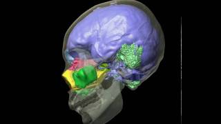 Human skull brain cast amp air sinuses  Roll [upl. by Ameehsat506]