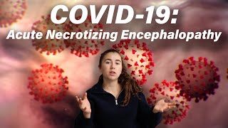 COVID19 Acute Necrotizing Encephalopathy [upl. by Arst718]