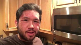 How to Cure Psoriasis Naturally Chinese Herbal Medicine [upl. by Myrta]