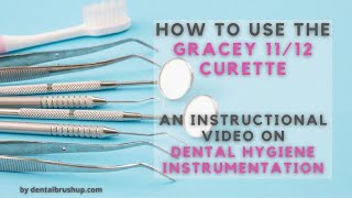 How to use the Gracey 1112 Curette [upl. by Gahl978]