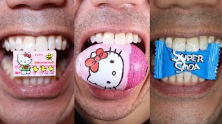 ASMR  Chocolate and Candy Sounds for Deep Sleep  Doctor Tristan Peh [upl. by Koren]