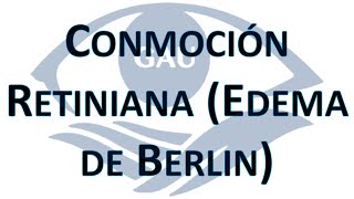 Conmoción Retiniana Edema de Berlin 04 Mayo 2022 [upl. by Leesa221]