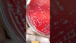 GRAM POSITIVE VS GRAM NEGATIVE BACTERIA GRAM POSITIVE VS GRAM NEGATIVE BACTERIA [upl. by Atiras]