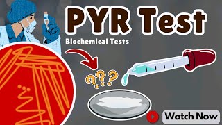 PYR Test The Easy Way to Identify Microbes  Biochemical Tests for Microbial Identification [upl. by Howlyn4]