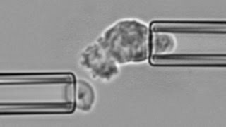 Chemotaxis and phagocytosis by a neutrophil encountering zymosan [upl. by Eglanteen718]