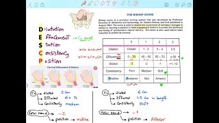 BISHOP SCORE Mnemonic Normal Labor [upl. by Anialem]