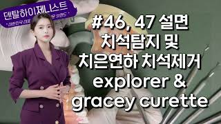 하악 우측 구치부 설면 치석탐지 밎 치은연하치석제거 explorer amp gracey curette 치과위생사 국가고시 실기시험 [upl. by Hertha]