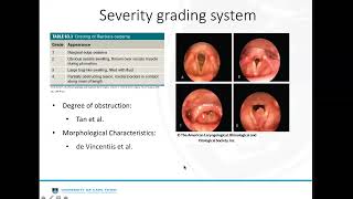 Update on Reinkes Oedema Dr Shavina Frank [upl. by Siroled]