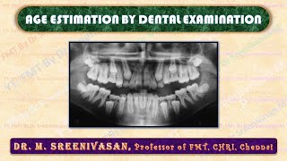 AGE ESTIMATION BY DENTAL EXAMINATION [upl. by Hyacintha788]