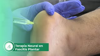 Terapia neural en fascitis plantar [upl. by Madalyn]