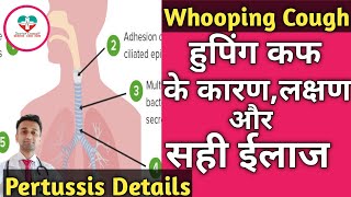 Whooping Cough  Pertussis हुपिंग कफ किसे हो सकता है ईलाज क्या है पूरी जानकारी। [upl. by Dimitri316]