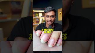 Check Your NAILS NOW shortsindia millionairemindset viralvideo [upl. by Kaltman973]