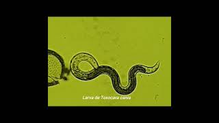 Larva de Toxocara canis [upl. by Lanfri141]