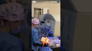 Myopia ReLex SMILE laser procedure 🤓 relexsmile myopia astigmatism 近视 飞秒手术 [upl. by Teresina]