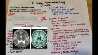 Single Peroxisomal Protein Deficiency Diseases  XLinked Adrenoleukodystrophy and Refsum Disease [upl. by Pals]