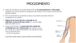 PROCEDIMIENTOS DE UROLOGIA [upl. by Ettellocin825]