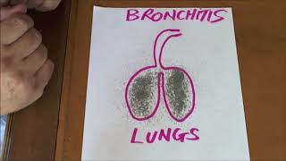 How to Cure Chronic Bronchitis Permanently [upl. by Eladroc414]