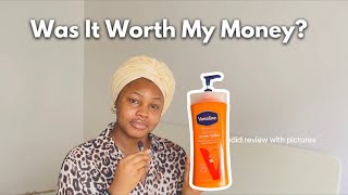 Candid Review of The Vaseline HEALING Even Tone with pics [upl. by Clarissa]