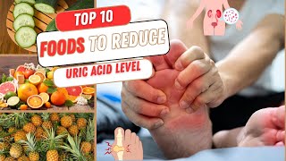 Top 10 Foods That Reduce Your Uric Acid Level [upl. by Einnok878]