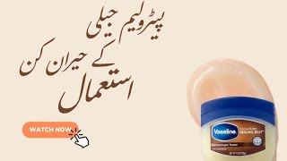 Amazing Uses Of Vaseline For Skin  Simple Hacks VaselinePetroleum jelly Beauty Uses [upl. by Sirois]