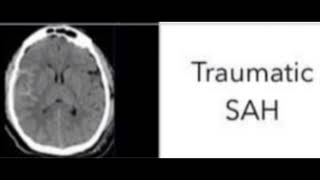 Types of head injury and treatment pls support my channel 🙏🙏 like and subscribe 🙏 [upl. by Larsen]