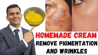 ONE SOLUTIONS FOR ALL SKIN PROBLEMS Cream To Remove Pigmentation And Wrinkles DrVivek Joshi [upl. by Joliet]