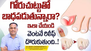 గోరుచుట్టు పోవాలంటే  How to Cure Paronychia  Nail Infection Treatment in Telugu  Healthy Bones [upl. by Suivat]