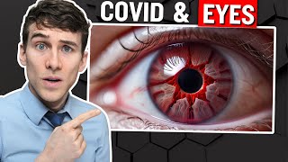 The SURPRISING Link Between Covid and Dry Eyes [upl. by Acirej]