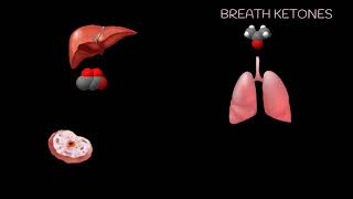 Ketogenesis Energy Needs Increase [upl. by Eila]