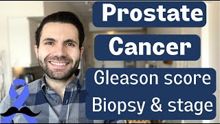 Beyond Diagnosis Prostate Cancer Biopsy GLEASON SCORE amp STAGING Explained [upl. by Morez]