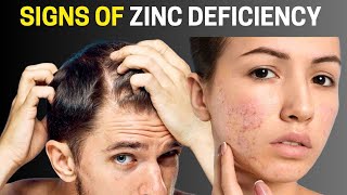 The 7 Warning Signs of Zinc Deficiency You MUST Know Avoid These Health Risks Now [upl. by Namqul113]