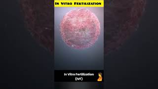 In Vitro Fertilization animation।।in vitro fertilization and embryo transfer ।।shortsivf [upl. by Arvad671]