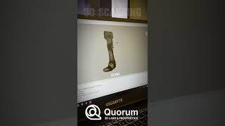 3D Scanning amp Design Services  By Quorum Prosthetics [upl. by Nidroj]