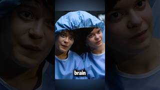 The twins shared a brain for 18 years shorts [upl. by Repotsirhc]