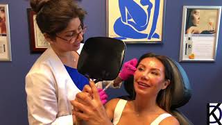 Cheek and Jawline Sculpting with Radiesse [upl. by Saretta]