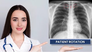 Assessment of Patient Rotation on Chest X ray [upl. by Maxine]