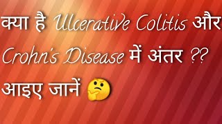 Ulcerative Colitis Versus Crohns Disease in Hindi Language [upl. by Venuti]