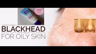 I used a Clean amp Clear Blackhead clearing scrub DAILY I GET RID OF BLACKHEAD IN 2 DAYS I Mini Review [upl. by Ahseuqram525]