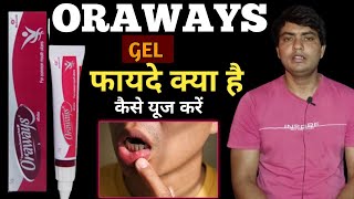 oraways gel uses in hindi  oraways kaise use kare  oraways gel  oraways mouth ulcer gel [upl. by Atiuqnahs]