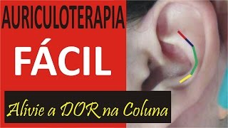 Auriculoterapia Nas Algias Vertebrais Aprenda Grátis Auriculoterapia [upl. by Trub]