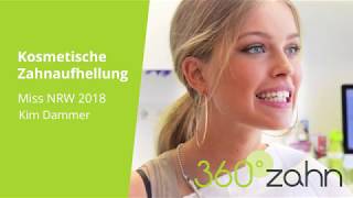 Kosmetische Zahnaufhellung  Miss NRW 2018  Kim Dammer bei 360°zahn [upl. by Daph]