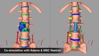 MSC Software Spine Research Institute Customer Testimonial Using Adams and MSC Nastran [upl. by Iluj]