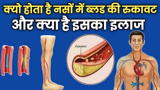 क्यो होता हैनसों में ब्लड की रुकावट और क्या है इसका इलाजhealth solution [upl. by Aniryt713]