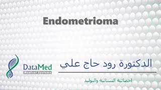 محاضرة دكتورة رود حاج علي Endometrioma [upl. by Savanna]