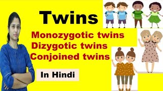 Twins  Types of Twins  Monozygotic Twins amp Dizygotic Twins  in Hindi [upl. by Downs]