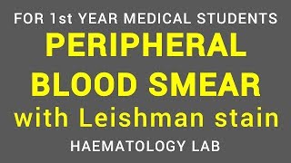 PERIPHERAL BLOOD SMEAR  LEISHMAN STAIN  HAEMATOLOGY LAB  PHYSIOLOGY [upl. by Wakeen]