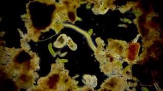 🔬 Mikroorganismen  microorganisms  Leben in der Pfütze  life dark field microscope [upl. by Laeno]