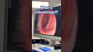 What is Colonoscopy proctologist [upl. by Dniren]